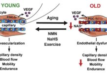 Boosting enzyme may help improve blood flow, fitness in elderly