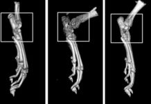 Drug compound shows promise against rheumatoid arthritis