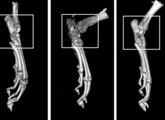 Drug compound shows promise against rheumatoid arthritis