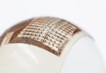 Flexible ultrasound patch could make it easier to inspect damage in odd-shaped structures
