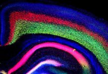 Can’t Sleep? It Could be Down to Genetics