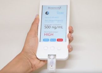 Israel-Singapore partnership sires $5 devices to detect dengue fever, strokes