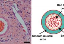 Lab surprised to find its drug-delivery system can help even without drugs