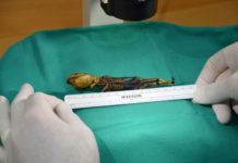 Mysterious skeleton shows molecular complexity of bone diseases