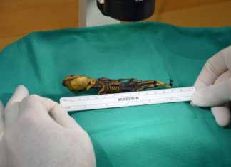 Mysterious skeleton shows molecular complexity of bone diseases