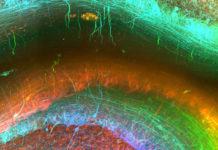 NEW TISSUE TECHNIQUE GIVES STUNNING 3D INSIGHTS INTO THE HUMAN BRAIN
