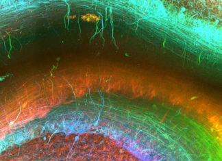 NEW TISSUE TECHNIQUE GIVES STUNNING 3D INSIGHTS INTO THE HUMAN BRAIN