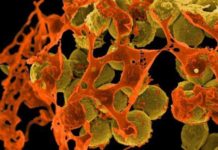Nerve cells found to suppress immune response during deadly lung infections