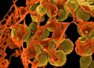 Nerve cells found to suppress immune response during deadly lung infections