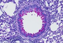 Nervous system puts the brakes on inflammation