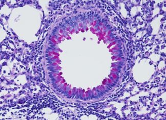 Nervous system puts the brakes on inflammation