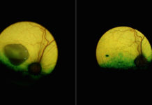 New gene therapy corrects a form of inherited macular degeneration in canine model