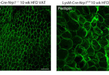 Obesity and health problems: New research on a safeguard mechanism