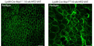 Obesity and health problems: New research on a safeguard mechanism