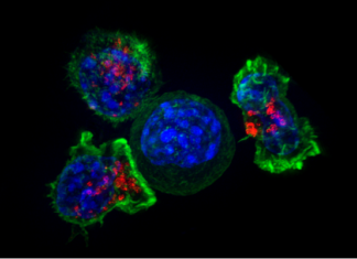 Obesity is shifting cancer to young adults