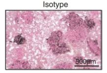 Preventing tumors from shedding their identifying proteins allows immune system to attack