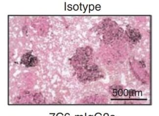 Preventing tumors from shedding their identifying proteins allows immune system to attack