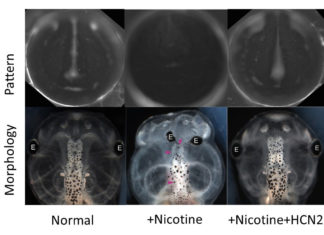 Researchers rescue embryos from brain defects by re-engineering cellular voltage patterns