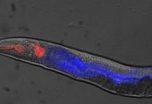 Rigor mortis in worms offers new insight into death
