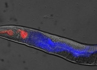 Rigor mortis in worms offers new insight into death