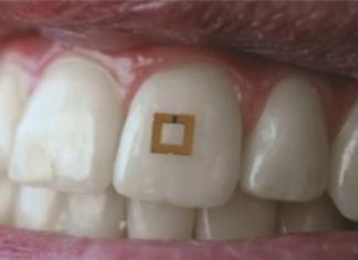 Scientists develop tiny tooth-mounted sensors that can track what you eat