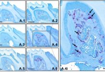 Study: Absence of key protein, TTP, rapidly turns young bones old