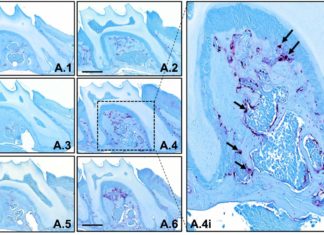 Study: Absence of key protein, TTP, rapidly turns young bones old