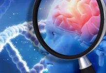 Study Links Physical Characteristics and Brain Health in Psychosis