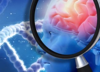 Study Links Physical Characteristics and Brain Health in Psychosis