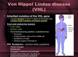 Study sheds new light on Von Hippel-Lindau syndrome