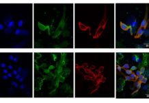 Virus-like particle could lead to new cancer vaccine