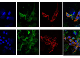 Virus-like particle could lead to new cancer vaccine