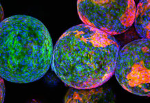 Scientists launch global effort to model pancreatic beta cell, solve diabetes