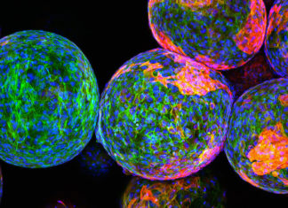 Scientists launch global effort to model pancreatic beta cell, solve diabetes