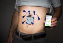 A wearable system to monitor the stomach’s activity throughout the day