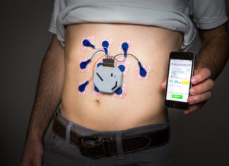 A wearable system to monitor the stomach’s activity throughout the day