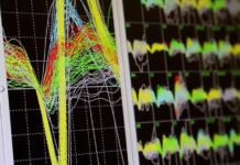 A Heavy Working Memory Load May Sink Brainwave ‘Synch’