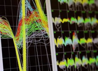 A Heavy Working Memory Load May Sink Brainwave ‘Synch’
