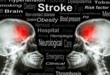 A better clot-buster drug for strokes?
