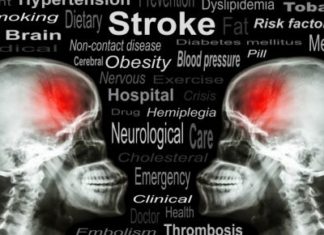A better clot-buster drug for strokes?