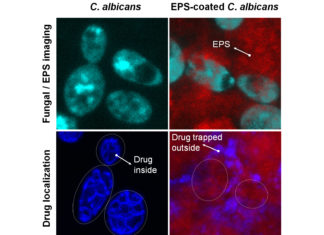 Bacteria boost antifungal drug resistance in severe childhood tooth decay