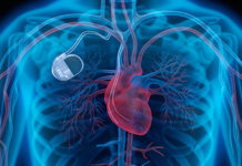 Spoonful of sugar helps infection detection