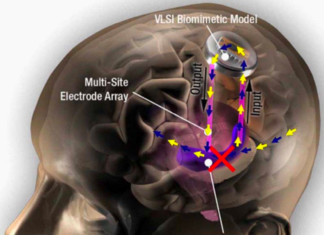 DARPA Funded Study Successfully Tests Prosthetic Memory Brain Implants