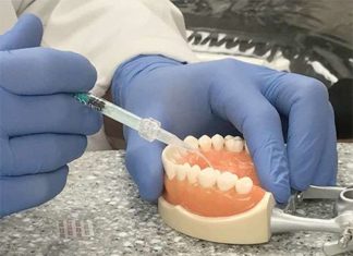Drug-filled, 3-D printed dentures could fight off infections