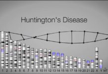 Excess of Mitochondrial Iron Linked to Huntington’s Disease