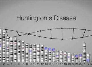 Excess of Mitochondrial Iron Linked to Huntington’s Disease
