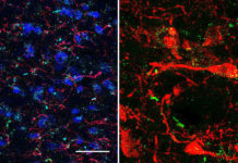 FDA-approved drugs to treat diabetes and obesity may reduce cocaine relapse and help addicted people break the habit