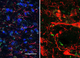 FDA-approved drugs to treat diabetes and obesity may reduce cocaine relapse and help addicted people break the habit