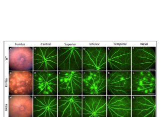 Fighting diabetic blindness: Researchers develop new target to study potential treatments