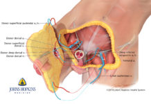 Johns Hopkins performs first total penis and scrotum transplant in the world